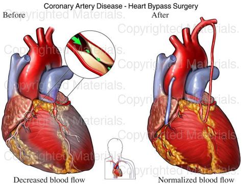 Pin On Cardiology