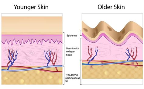 What Is Retinol And Why Do You Need It