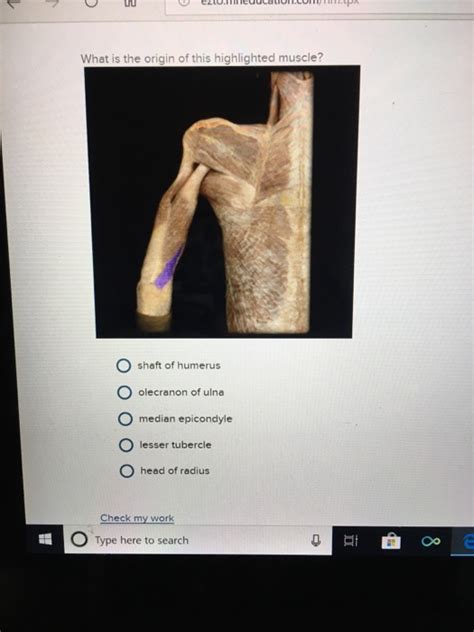 Solved What Is The Origin Of This Highlighted Muscle O Chegg