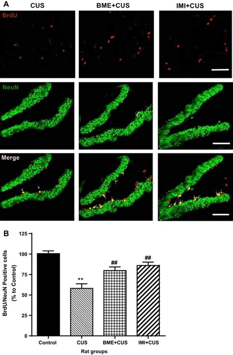 Representative Photomicrographs Of Brdu Neun Positive Cells In