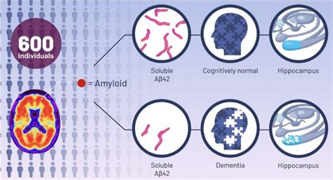 Study Proposes Increasing Soluble Beta-Amyloid to Treat Alzheimer’s ...