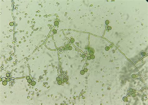 Microbio On Twitter 🚨clamidoconidios De Candida Albicans Inducidos En Agar Harina De Maíz