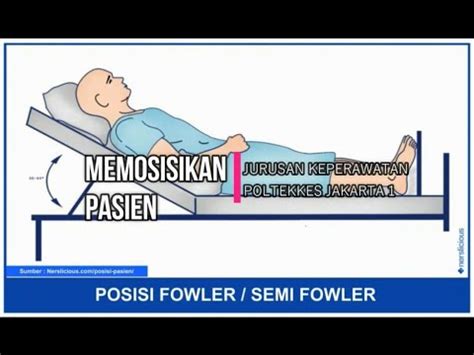 Prosedur Posisi Fowler Dan Semi Fowler YouTube