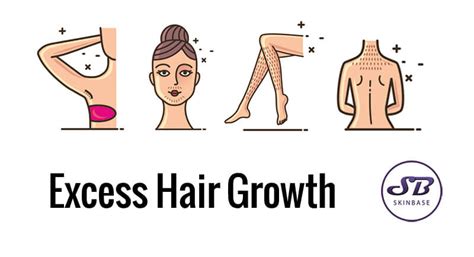 Excess hair growth? Hirsutism, can we treat it?