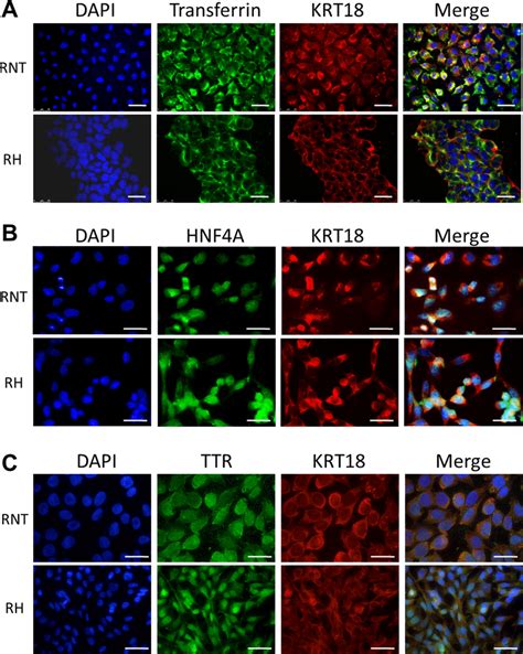 Expression Of Transferrin Hepatocyte Nuclear Factor Alpha And