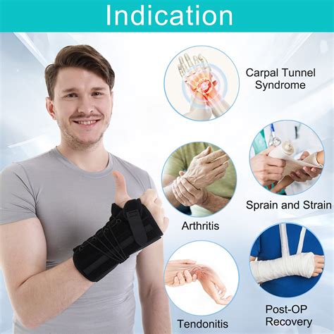 De Quervain Syndrome Exercise Ph