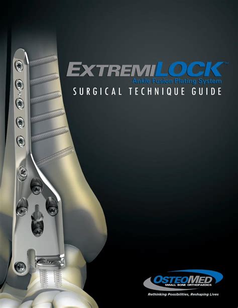 PDF SYSTEM OVERVIEW 5 OsteoMed Ankle Plating SYSTEM OVERVIEW