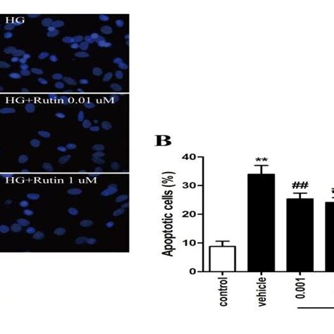 Effect Of Rutin On High Glucose Induced Cell Viability And Ldh Release