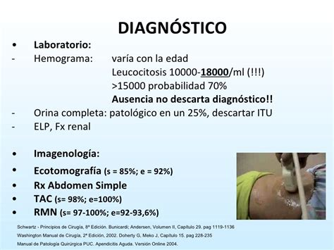 Apendicitis Aguda 0809