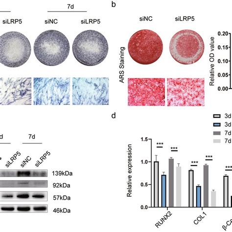 Overexpression Of Lrp Promotes Osteogenic Differentiation Of Pdlscs