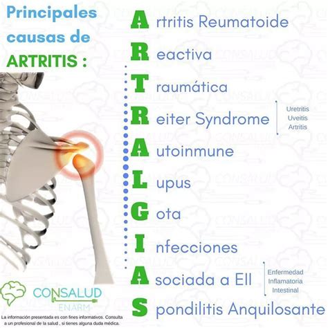 CONSALUD ENARM En Instagram MNEMOTECNIAS CONSALUD ARTRALGIAS ENARM