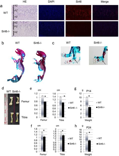 Sirt6 Is Expressed In Chondrocytes A Immunohistological Analysis Of