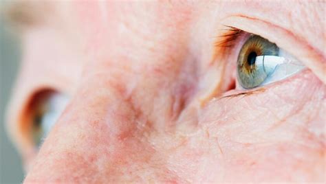 Black Spots In Vision Causes With Treatment