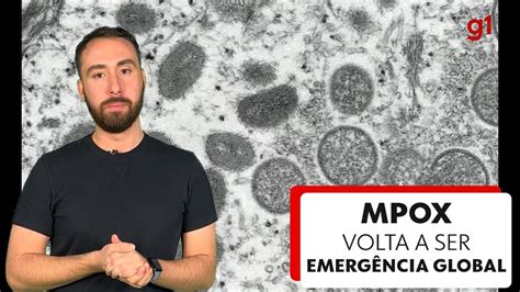 Mpox volta a ser uma emergência sanitária global diz OMS tire dúvidas