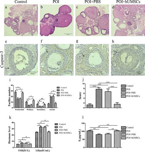 Effects Of HUMSC Transplantation On Ovarian Tissue Histopathology