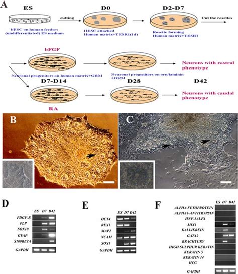 Differentiation Of Hesc To Neural Progenitors A Schematic