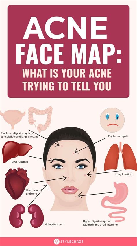 Acne Face Map What Your Breakouts Are Trying To Tell You Face Mapping Acne Face Acne Face