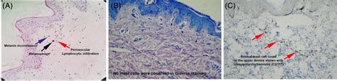 Histopathological Findings Of Skin Lesions In The Fifth Month Increase