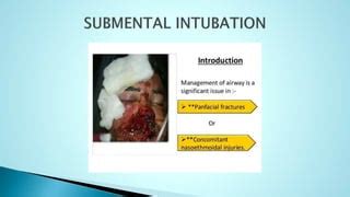 Submental Intubation Pptx