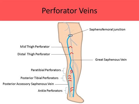 Ultrasound Registry Review Extremity Venous