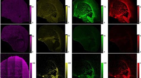 Intact Lipid Imaging Of Mouse Brain Samples MALDI Nanoparticle Laser