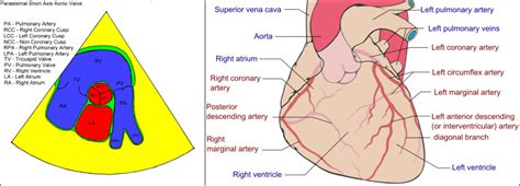 Coronary Arterial Pressure Evaluation Statpearls Ncbi Bookshelf