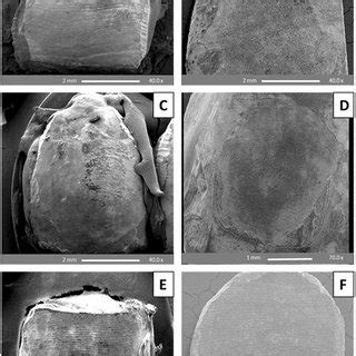 Sem Images Of Un Bracketed Premolar Buccal Enamel Surfaces A An