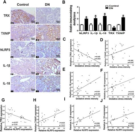 TRX TXNIP NLRP3 IL 1β and IL 18 expression is altered in the kidney