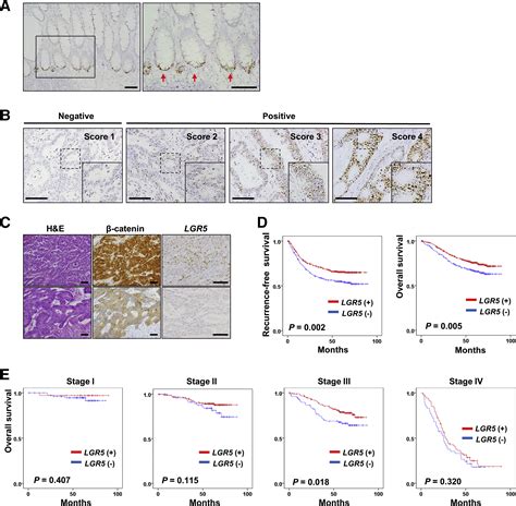 Expression Profile Of Lgr And Its Prognostic Significance In