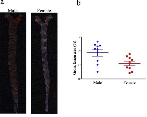 Figure 1 From Sex Differences In The Formation Of Atherosclerosis