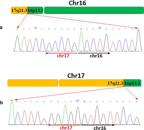 Sanger Validation Of The Breakpoints A Sanger Sequence Of Proband