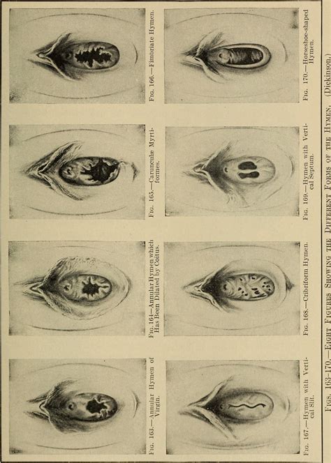 Showing Hymen Telegraph