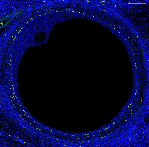 Cientistas criam primeiro atlas do ovário humano resolução ao nível