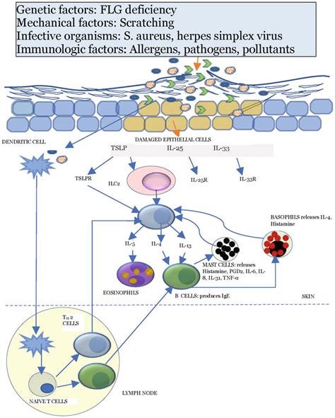 Atopic Dermatitis In Adults Epidemiology Risk Factors Pathogenesis