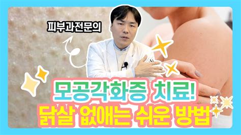 누구나 손쉽게 모공각화증 없애는 방법모공각화증 닭살피부 원인과 치료방법 아크리프 연세에이엔비피부과 이해진 원장