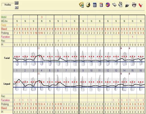 Ada Guidelines For Perio Charting - Best Picture Of Chart Anyimage.Org