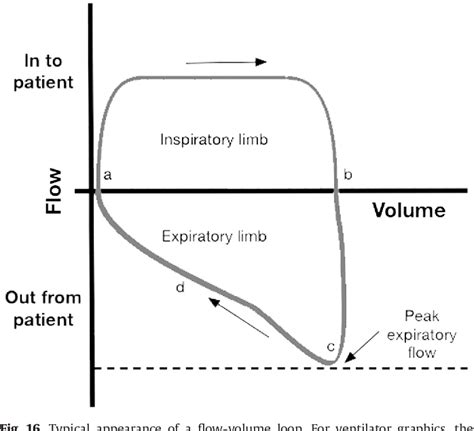 [PDF] Ventilator waveforms. | Semantic Scholar