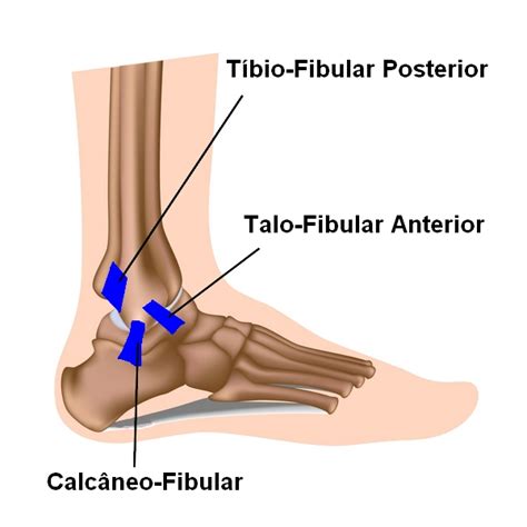 Optima Fisioterapia Entorse De Tornozelo