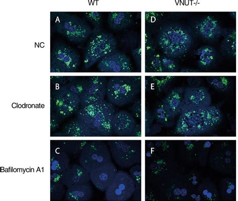 Accumulation Of Quinacrine Into Acidic Organelles Of Hepatocytes From