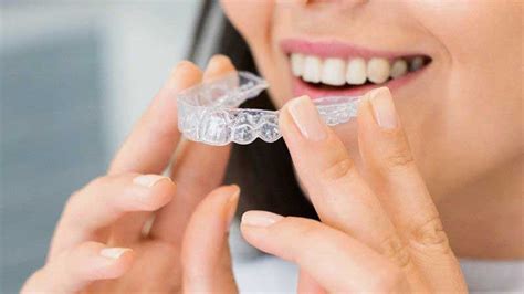 15 Facts About Invisalign You Need To Know Dental At Forest Hill