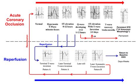 Acs Guidelines 2023 New Esc Update