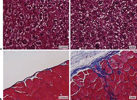 Massons Trichrome Staining Of Liver A And Peritoneum B 4 μm Thick