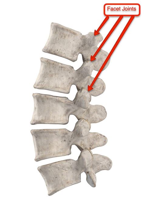 What Is Facet Hypertrophy? - Higher Vantage Point