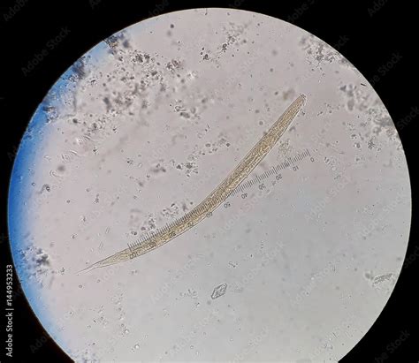 Parasite In Stool Under 40x Light Microscopy Strongyloides Stercoralis Is A Human Pathogenic