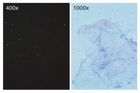 Auramine-Rhodamine Fluorochrome Staining: Principle, Procedure, Results and Limitations - Learn ...