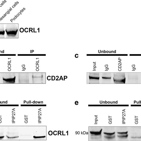 Immunoprecipitation And Protein Pull Down Analysis Showing Interaction