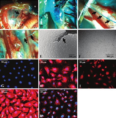 Isolation Of Lymphatic Endothelial Cells A And B Isosulfan Blue