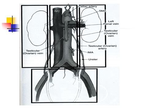 Abdominal Trauma Zones