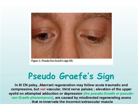 Pseudo Ophthalmology