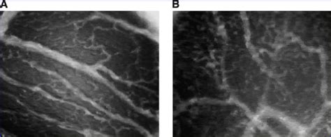 OPS Imaging Analysis Showed No Significant Difference Regarding The